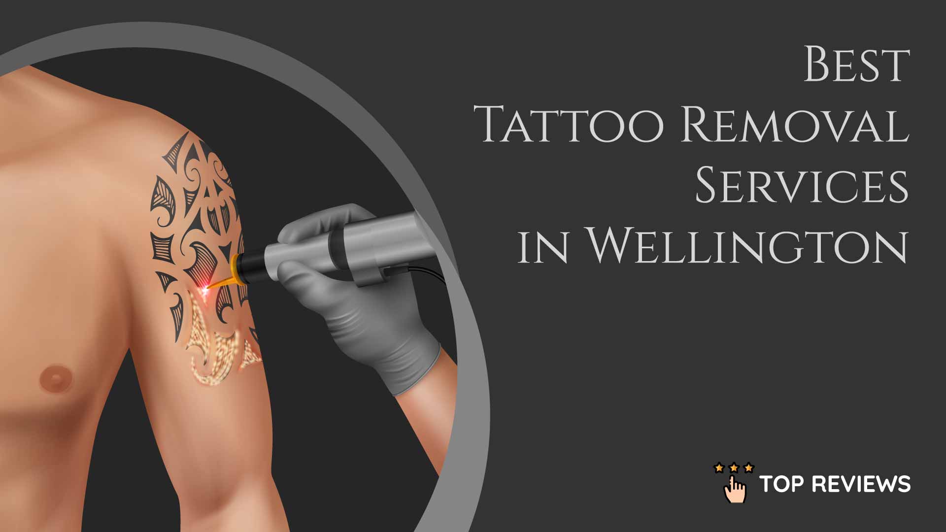 Best Tattoo Removal Services in Wellington